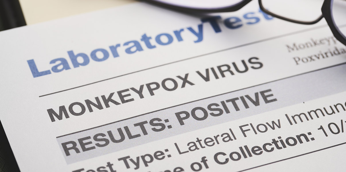 EVS Provider - Monkeypox Disease