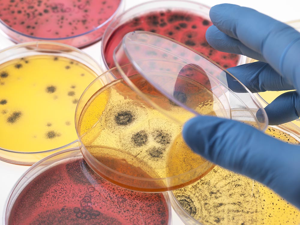 Microbial Contaminants